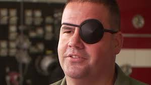 Firefighter learns to work after being stabbed in the eye