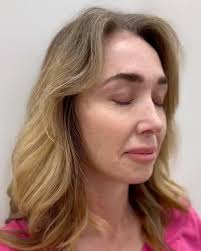 Elite Aesthetics, LLC