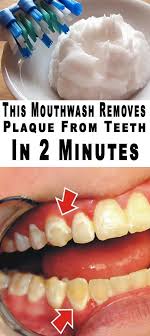 How To Remove Tartar From Teeth Without Dentist How To Remove Calculus From Teeth Without Going To The Dentist Pla Teeth Health Dental Health Healthy Teeth