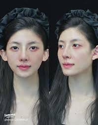 25 top 脸部拨筋护理上课程ideas in 2025