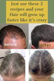 Just Use These 2 Recipes And Your Hair Will Grow Faster Like It S Crazy Hair Cure Mayonaise Hair Treatment Grow Hair Faster