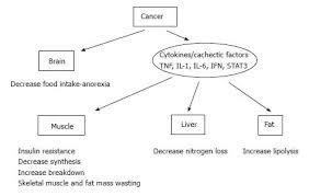 Image result for Cachexia in Cancer