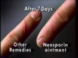There was no statistical difference between using petroleum jelly with antibiotic and without.9﻿ you may decide to trust your body to heal the way it's supposed to without using the ointment. Neosporin Youtube