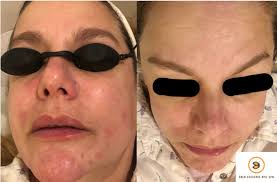 Chen Skincare and Spa