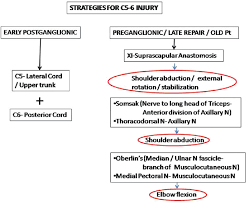 Adult Brachial Plexus Injuries Surgical Strategies And