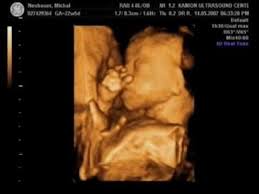 Pin On Abolish Abortion