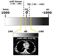 X Ray Ct Technique Startradiology Magnetic Resonance X Ray X Ray Tube