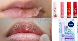 Cara merawat bibir agar merah alami. Thread Menarik Pasal Bibir Kering Produk Drugstore Paling Sesuai Digunakan Perkongsian Dari Netizen Hijabista