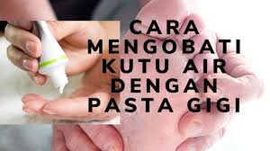 Cara Mengobati Kutu Air Dengan Pasta Gigi Youtube
