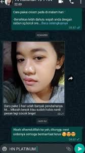 We did not find results for: Review Cream Hn Platinum Bpom Original Manfaat Harga Efek Samping Perbedaan Asli Dan Palsu