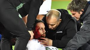 Zwischen 2010 und 2014 spielten robert lewandowski und neven subotic gemeinsam für borussia dortmund. Ex Bvb Star Neven Subotic Verlor Mehrmals Das Bewusstsein Welt