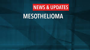 The five year survival rate for mesothelioma is approximately 6.3%. Model Remains The Standard For The Prognosis Of Malignant Pleural Mesothelioma Cancerconnect