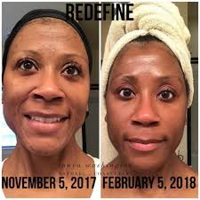 Back to work after breast cancer