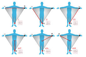 Electrocardiography Wikipedia