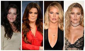 Pin On Celeblens Celebrity Plastic Surgery Before And After Photos
