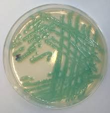 Image result for Striga baumannii