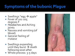 Browse 7,473 buboes stock photos and images available, or search for bubonic plague to find more great stock photos and pictures. 1347 And On Recognize The Possible Causes Of Change In Civilizations Diseases Bubonic Plague Identify Conclusions About Early World Historical Ppt Download