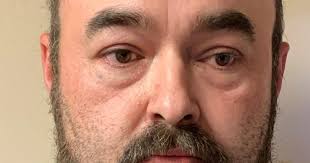 Tupelo man sentenced to 20 years for sexual abuse of toddler