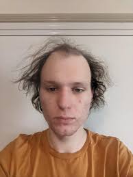 Been in the depths of depression for a while now. Trying to make a  concerted effort to get better but I just cant feel good about myself with  hair like this. Need