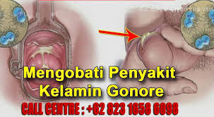 Ini Dia Cara Paling Berkesan Tuk Simbuhkan Kencing Tak Lawas Pada Lelaki