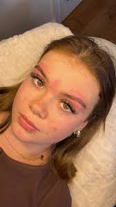 Could anyone edit out the redness