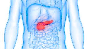 Colon cancer treatments can include surgery, radiofrequency ablation, cryosurgery, chemotherapy, radiation therapy, and targeted therapy. Cancer Du Pancreas Une Chimiotherapie Prolonge La Survie Des Malades Roseup Association