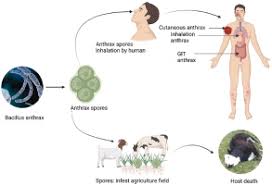 Image result for Anthrax