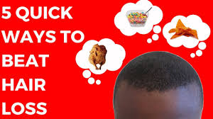 However, if you ask me, i can detect a little thinning at the temples. Stop Ejaculation Male Teenager Balding In Their 20 S Kt The Arch Degree Youtube