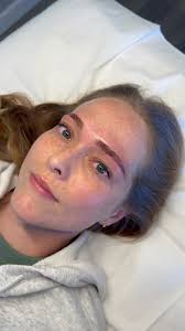 Chloe Wester (@chlo_glow_skin) • Instagram photos and videos