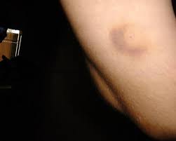 We did not find results for: Pin On Exercise