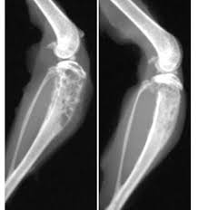 You will find a list of common tests, procedures, and scans that doctors use to find out the cause of a medical problem.use the menu to see other pages. Huntsman Scientists Identify Bone Degradation Process Within Metastatic Breast Cancer