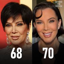 Be honest 👀 Do you prefer #krisjenner BEFORE or AFTER?