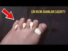 Ayaginiza Sarimsak Sarip Yatarsaniz Bakin Neler Olur Denemeyenler Pisman Youtube 2020 Saglik Egitim Tarihi Saglikli Yasam