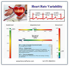 Heart Rate Variability Test Karuna Flame Co Sligo Ireland
