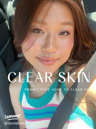 Ole Henriksen Cold Plunge Pore Mask Review: Is It Worth the Hype?