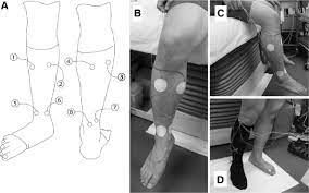 Measurement Of The Exerted Pressure By The Compression Stockings A Download Scientific Diagram