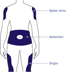 injecting lantus insulin glargine injection 100 units ml