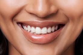 Blanchir Ses Dents Instantanement Video