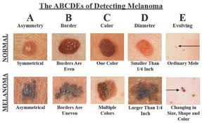 the skin cancer detector that could save your life