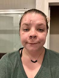 Who is Erin Carter? Good grief! I tripped up 1 step at the movie theater  last summer and broke my shoulder. Erin, however…. well, you watch it.