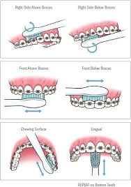 Cold beverages have the added bonus of numbing your mouth. Oral Hygiene Hacks For Kids With Braces Thomas Orthodontics