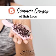 Hereditary baldness, aka male or female pattern baldness, is primarily hormonal; 5 Common Causes Of Hair Loss The Organic Dietitian