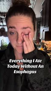 Todo lo que comí hoy sin esófago