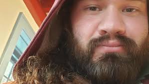 Fundraiser for Andrew Wayand by Ian Retamar : Andrew's Smile Restoration  Journey