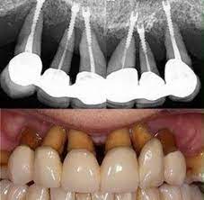 Chto Eto Photoshop Ili Tak I Dolzhno Byt Stomatologiya Dentistry Dental Hygenist Dental Fun Dental Humor