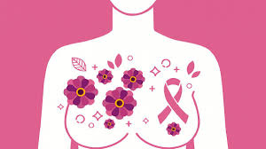 Síntomas del cáncer de mama y diagnóstico