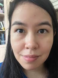 Tear trough fillers? Really torn about it and would love to hear some  opinions. : r/30PlusSkinCare