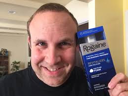 See a good doctor, work out a master plan with that doctor for your short and long term plans for the treatment of your hair loss. Some Real Hair Raising Advice For 20 Year Old Me Mommy S Busy Go Ask Daddy