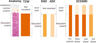 We did not find results for: Multiparametric Magnetic Resonance Imaging For Bladder Cancer Development Of Vi Rads Vesical Imaging Reporting And Data System European Urology