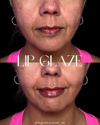 💧“LIP FILLER CAN'T LOOK NATURAL” Sure, Jan- tell that to my lip glaze 💋  💉the glaze is perfect for someone who is feeling a little deflated or  dehydrated but doesn't want to